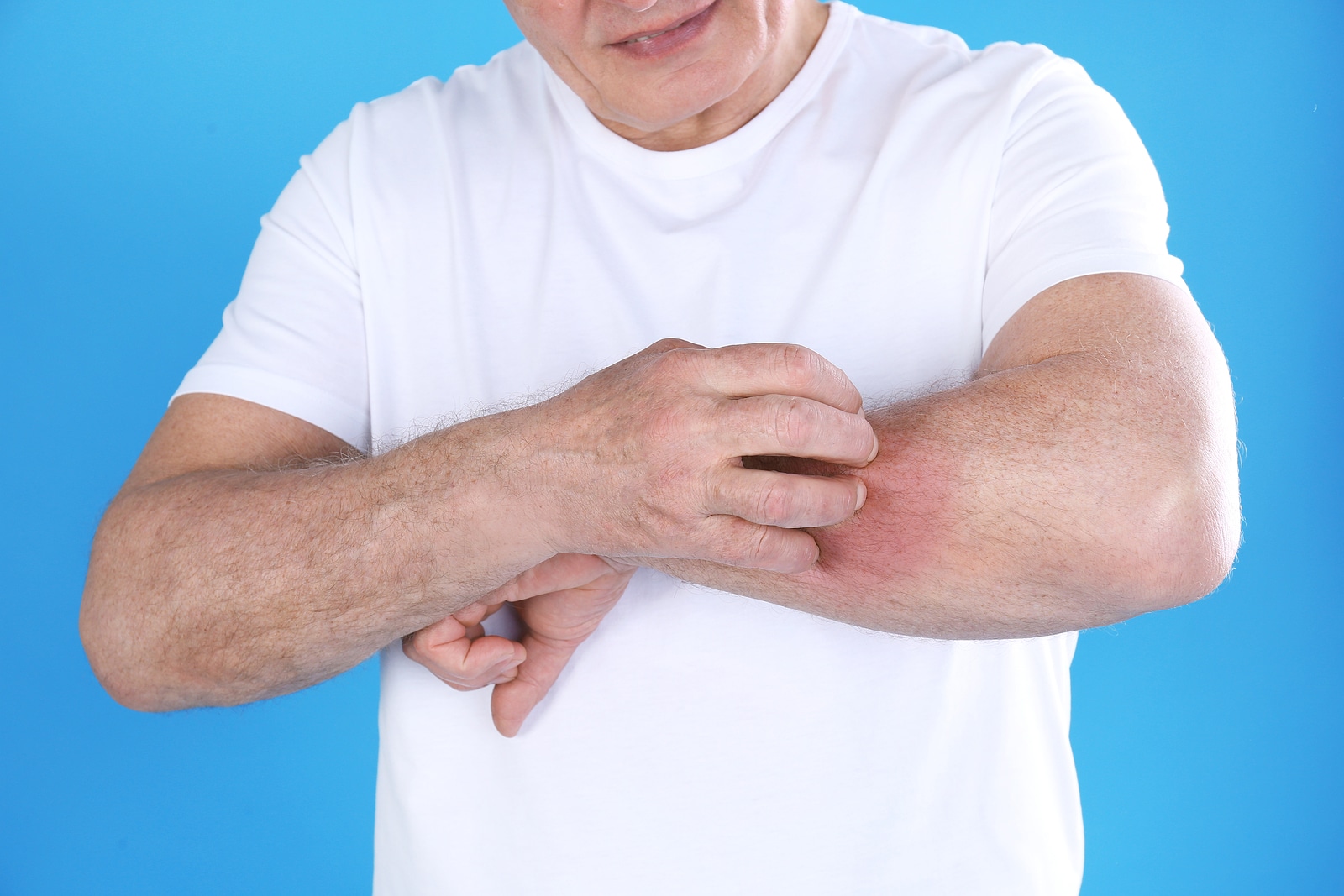 A Companion Care at Home Guide to Shingles - In Home Care San Diego | A ...